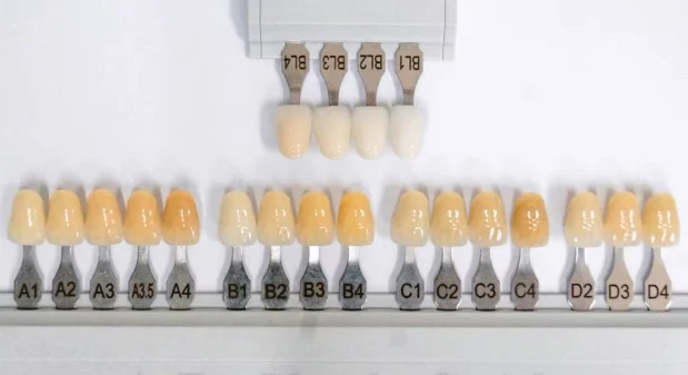 Shade Guide Warna Gigi