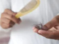 Cara Merawat Rambut Rontok Secara Efektif Agar Kembali Lebat
